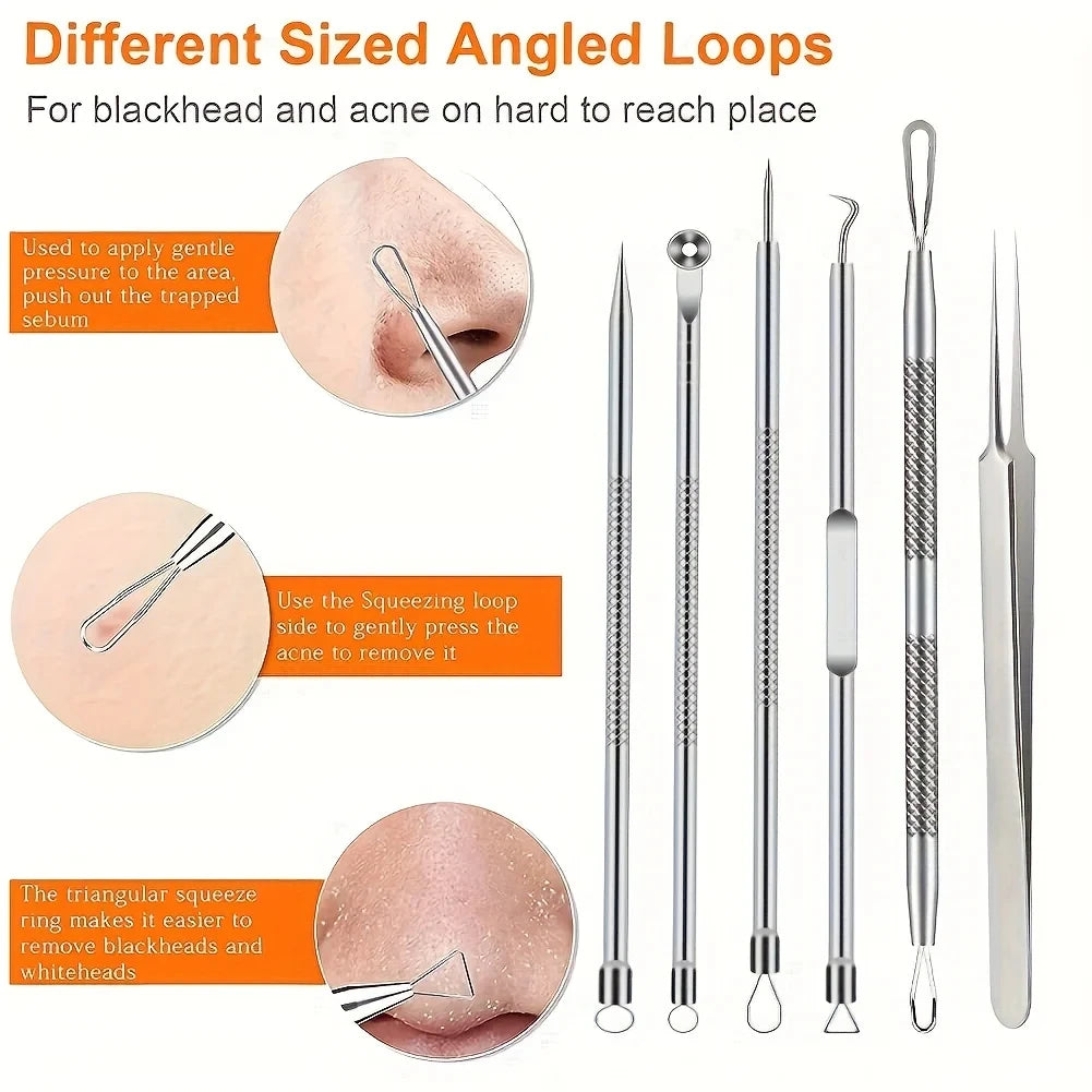 6-Piece Blackhead Tweezers Set